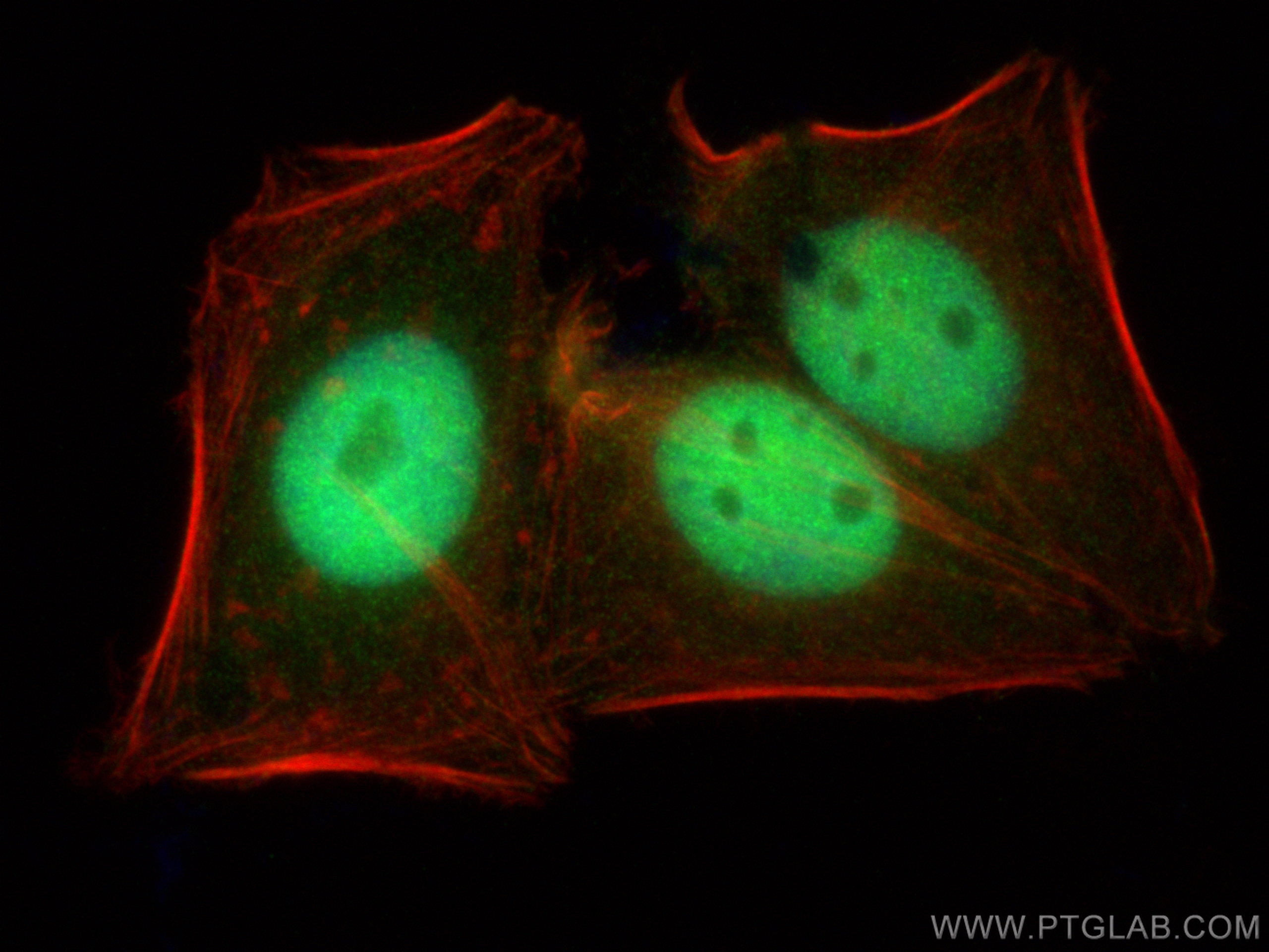 Immunofluorescence (IF) / fluorescent staining of HepG2 cells using Glucocorticoid receptor Polyclonal antibody (24050-1-AP)