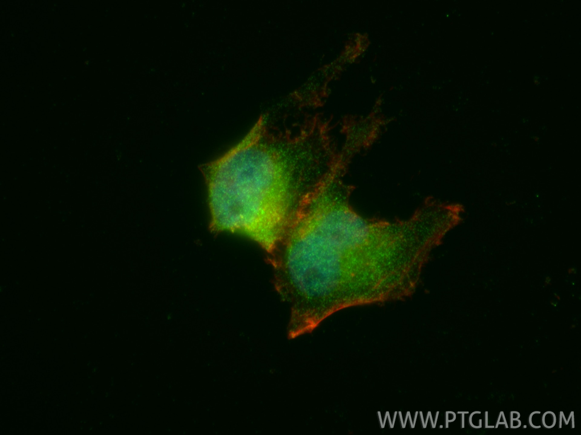 Immunofluorescence (IF) / fluorescent staining of HEK-293 cells using NR3C2 Polyclonal antibody (21854-1-AP)