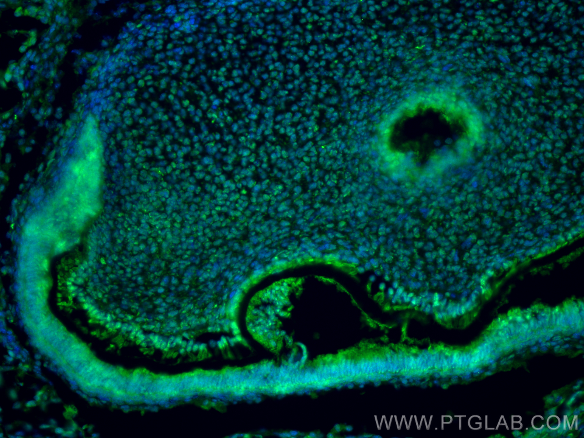 Immunofluorescence (IF) / fluorescent staining of Customer Sample customer using Nurr1/NR4A2 Polyclonal antibody (10975-2-AP)