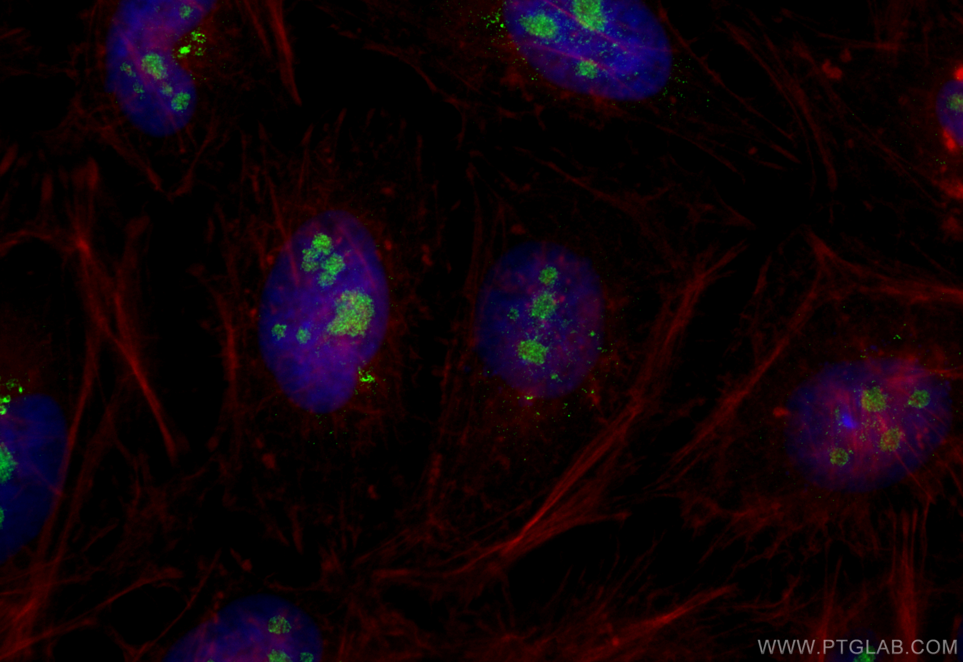 Immunofluorescence (IF) / fluorescent staining of HeLa cells using Nurr1/NR4A2 Polyclonal antibody (10975-2-AP)