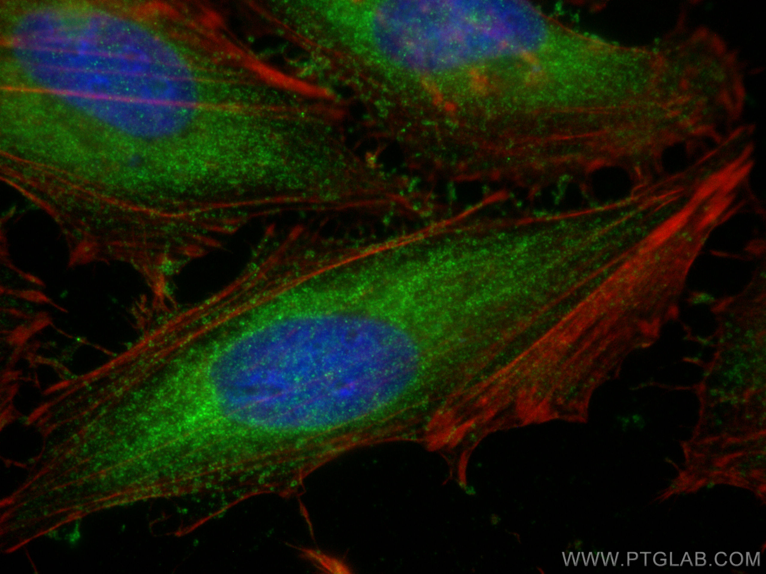 Immunofluorescence (IF) / fluorescent staining of HeLa cells using NRAS Polyclonal antibody (10724-1-AP)