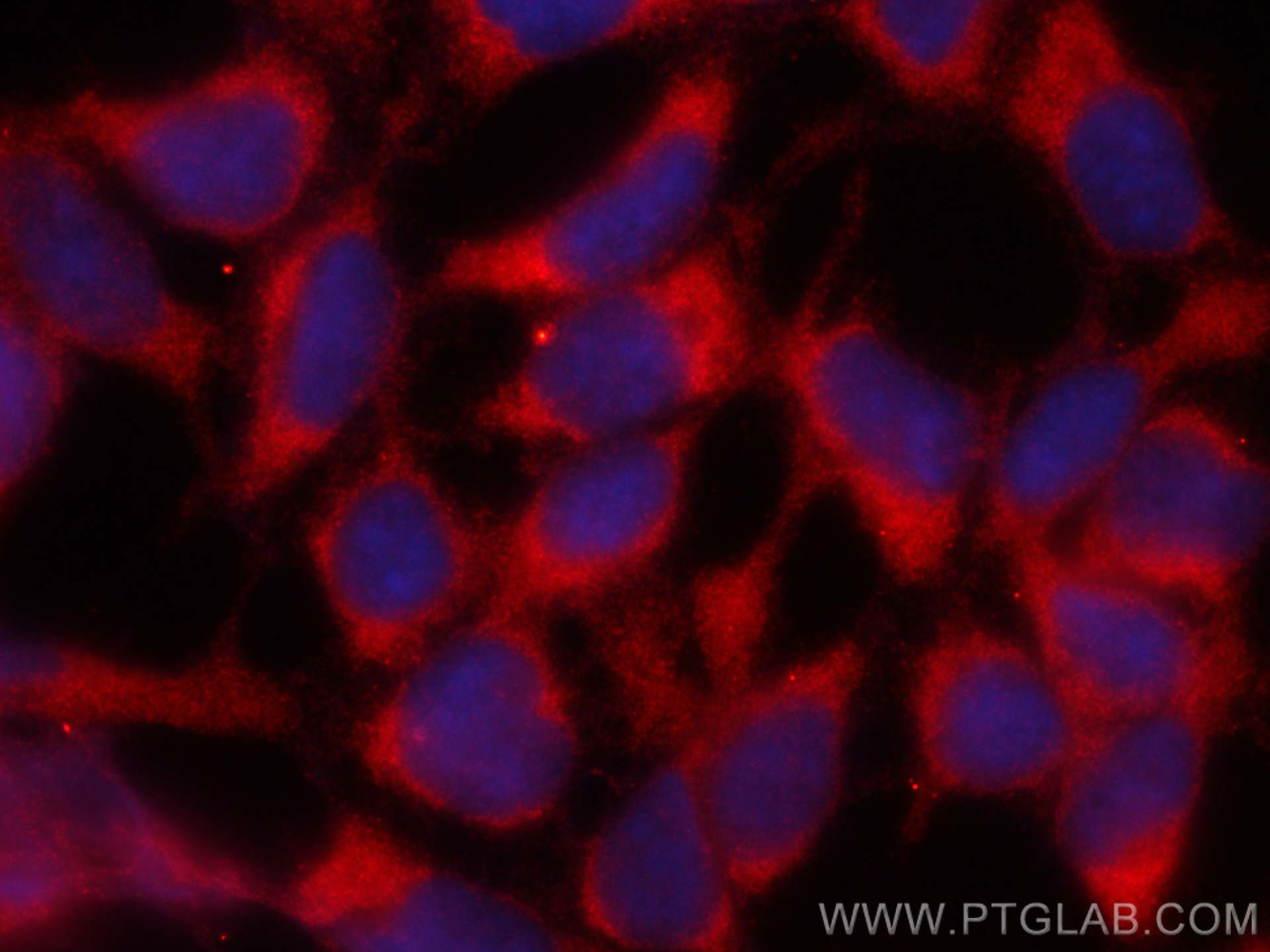 Immunofluorescence (IF) / fluorescent staining of HEK-293 cells using CoraLite®594-conjugated NRBP2 Monoclonal antibody (CL594-66687)