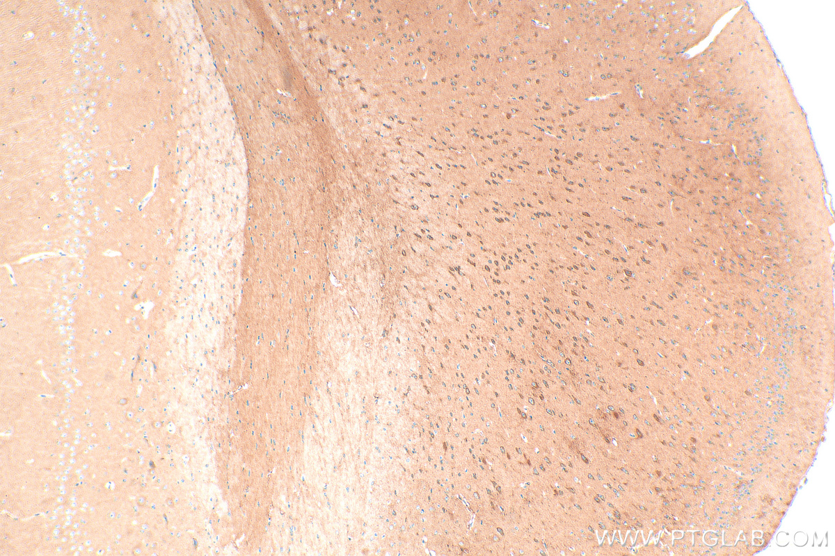 Immunohistochemistry (IHC) staining of mouse brain tissue using NRCAM Polyclonal antibody (21608-1-AP)