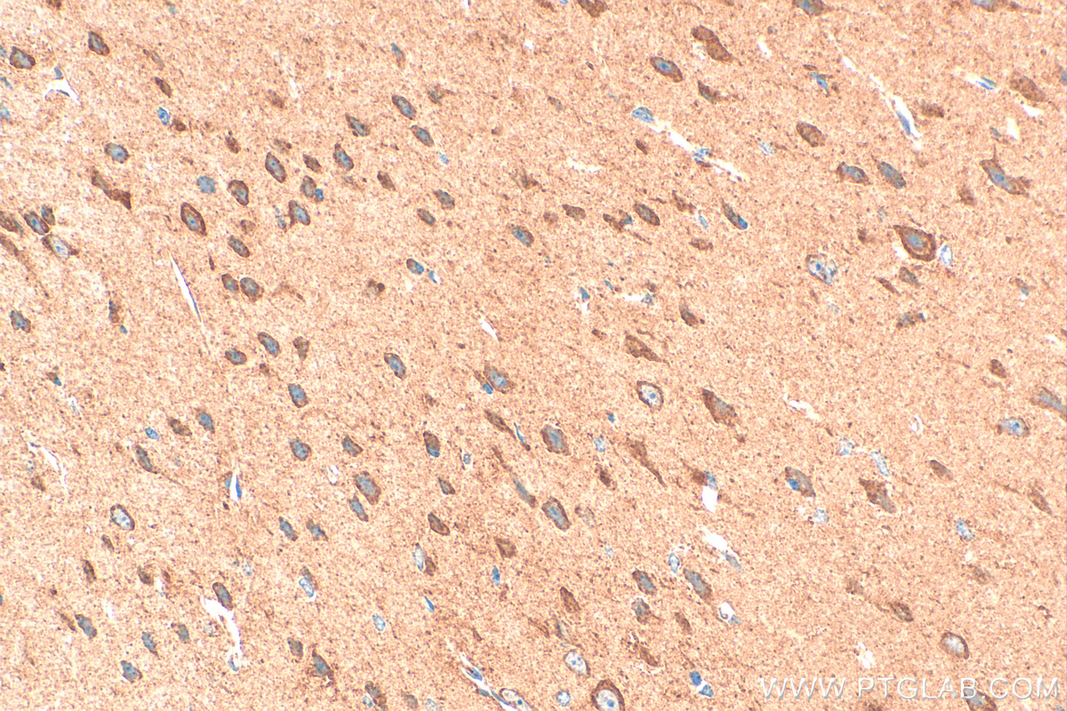 Immunohistochemistry (IHC) staining of mouse brain tissue using NRCAM Polyclonal antibody (21608-1-AP)