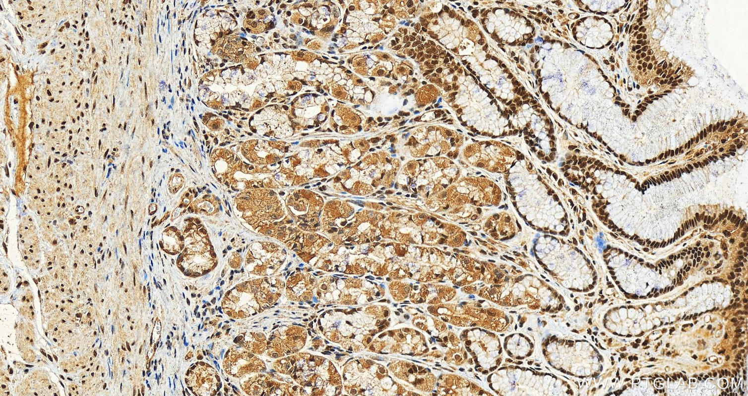 Immunohistochemistry (IHC) staining of human stomach tissue using NRF1/nuclear respiratory factor 1 Polyclonal antib (12482-1-AP)