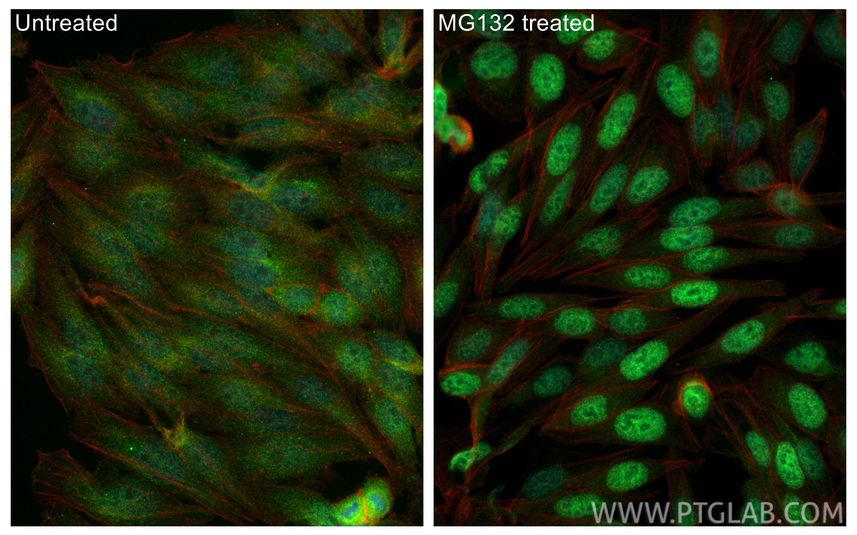 Immunofluorescence (IF) / fluorescent staining of HepG2 cells using NRF2/NFE2L2 Monoclonal antibody (66504-1-Ig)