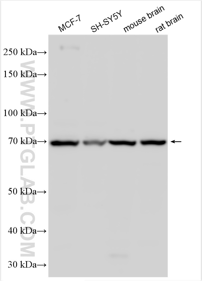 Western Blot (WB) analysis of various lysates using NRG1, isoform SMDF Polyclonal antibody (10527-1-AP)