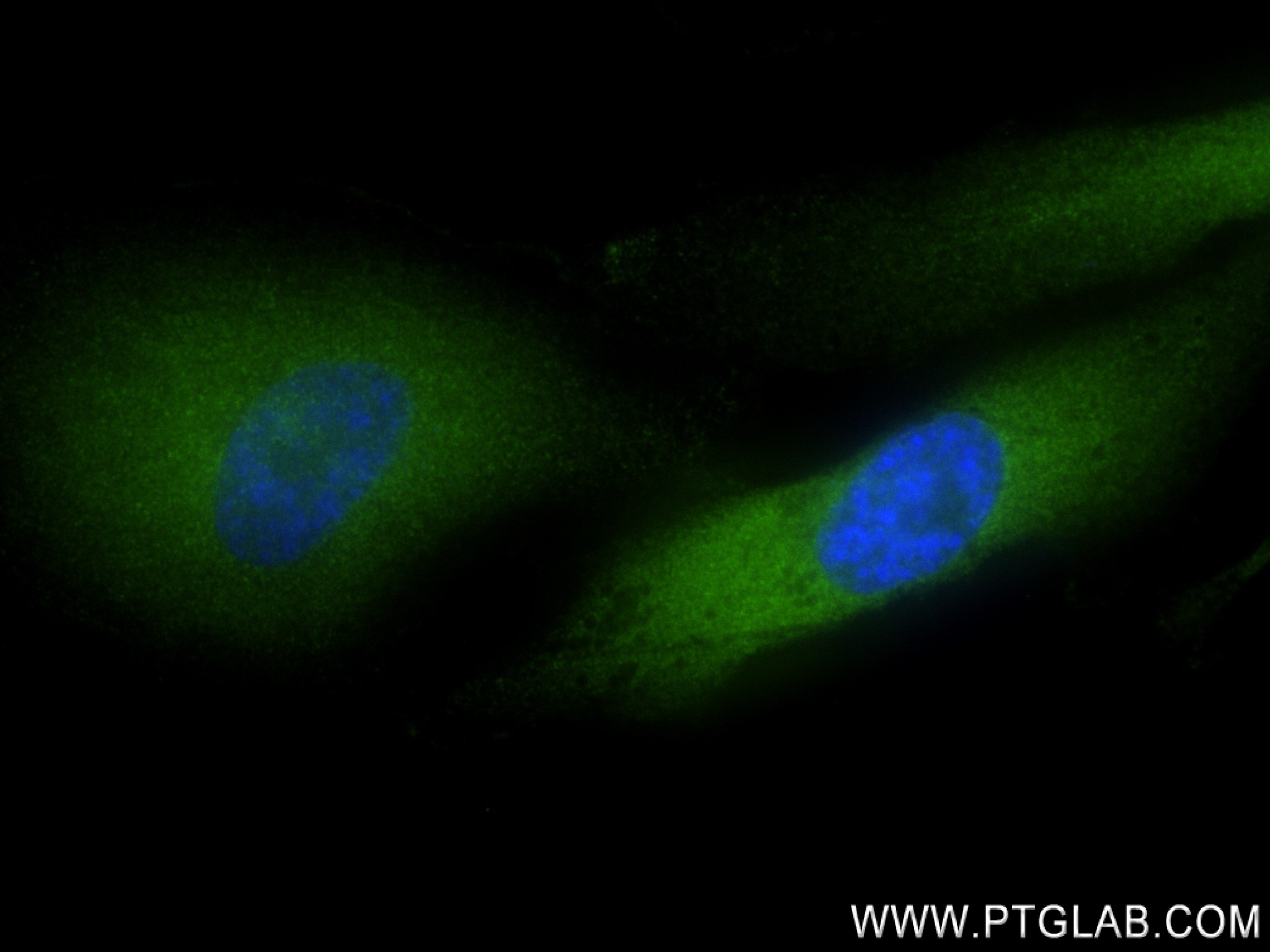 Immunofluorescence (IF) / fluorescent staining of MDA-MB-231 cells using NRG1, isoform Alpha Recombinant antibody (83251-2-RR)