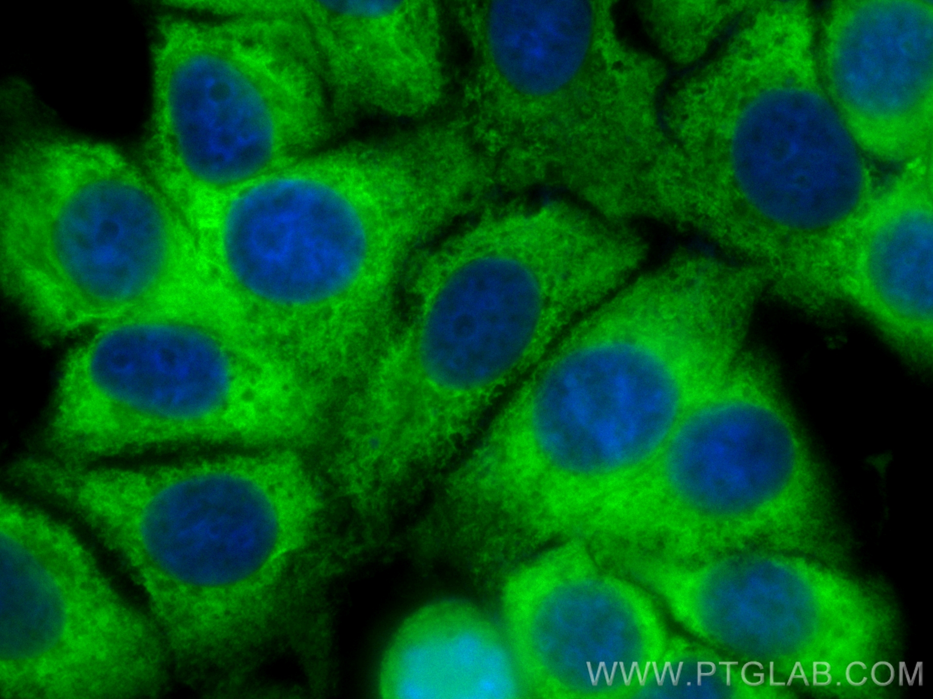 Immunofluorescence (IF) / fluorescent staining of MCF-7 cells using CoraLite® Plus 488-conjugated NRG1, isoform Alpha  (CL488-83251-2)