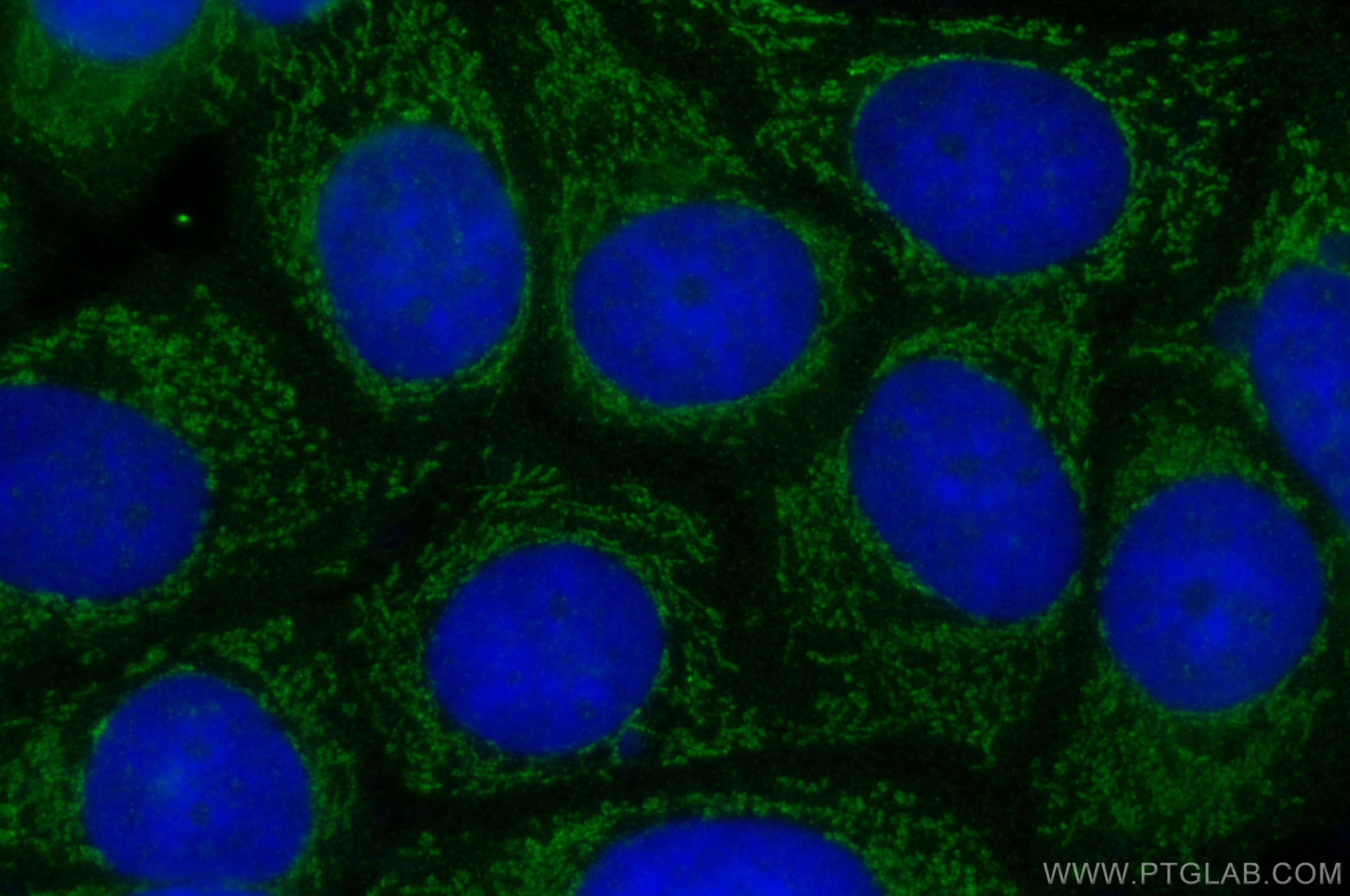 Immunofluorescence (IF) / fluorescent staining of MCF-7 cells using NRG1, isoform Beta1 Polyclonal antibody (31147-1-AP)