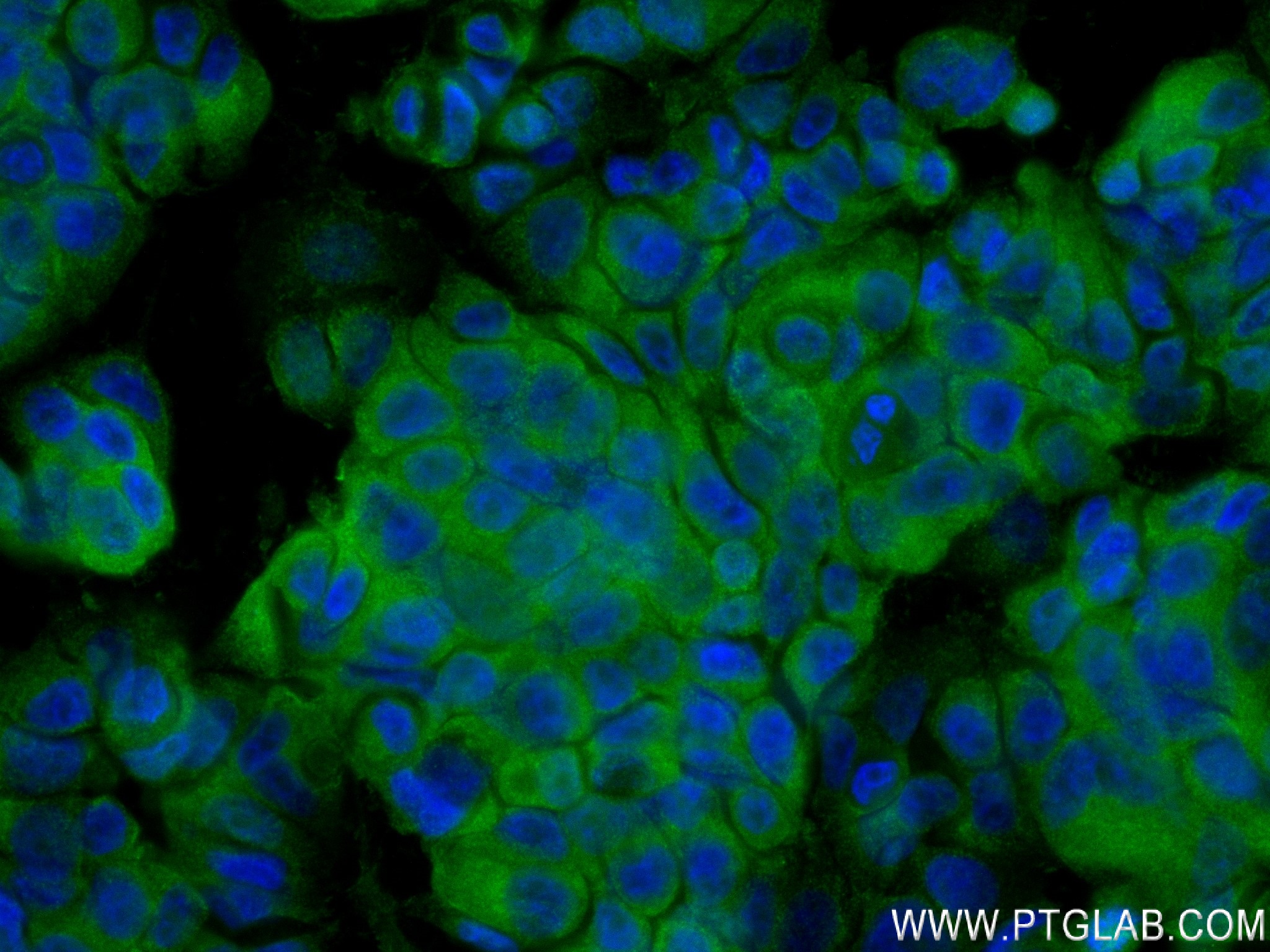 Immunofluorescence (IF) / fluorescent staining of MCF-7 cells using NRG1, isoform SMDF Recombinant antibody (83323-6-RR)