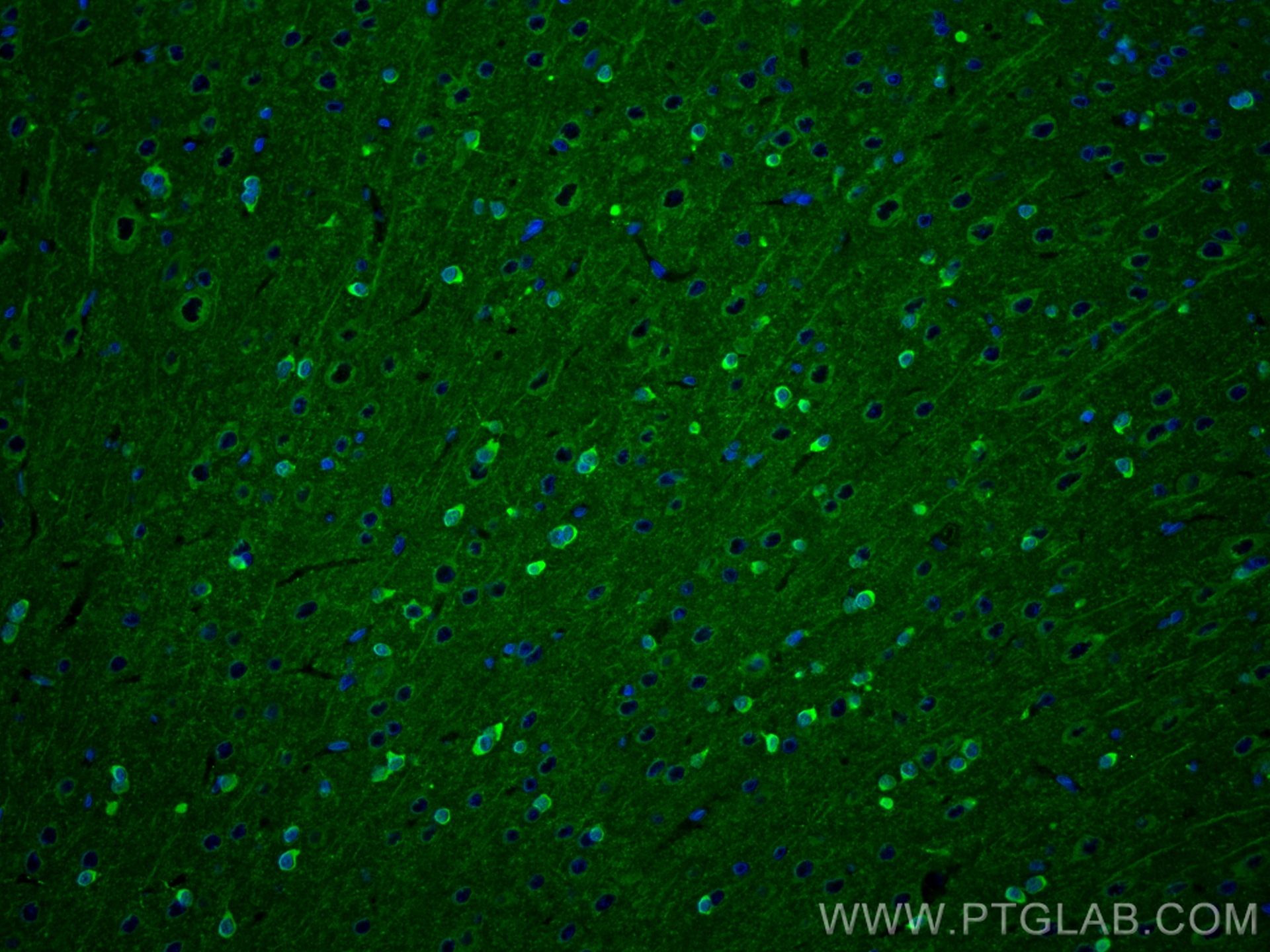 Immunofluorescence (IF) / fluorescent staining of rat brain tissue using NRG1, isoform SMDF Recombinant antibody (83323-6-RR)