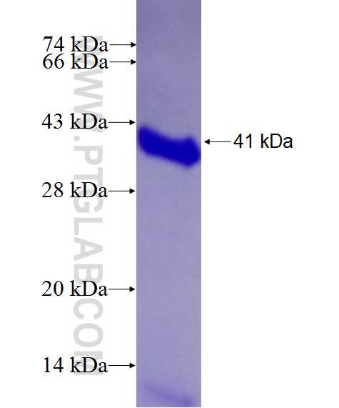 NRIP1 fusion protein Ag26614 SDS-PAGE