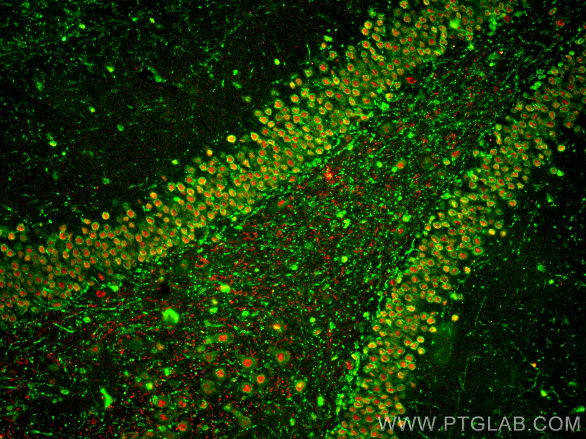 Immunofluorescence (IF) / fluorescent staining of rat brain tissue using NRXN2 Polyclonal antibody (30490-1-AP)