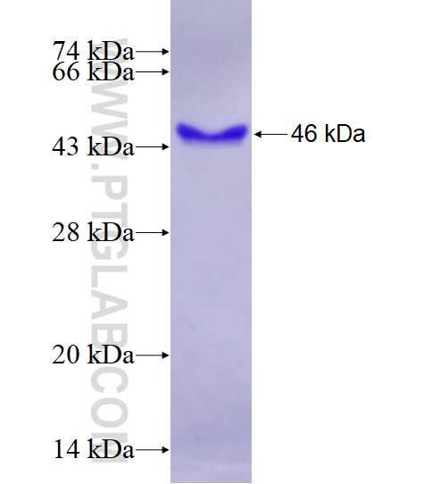 NSD1 fusion protein Ag26432 SDS-PAGE