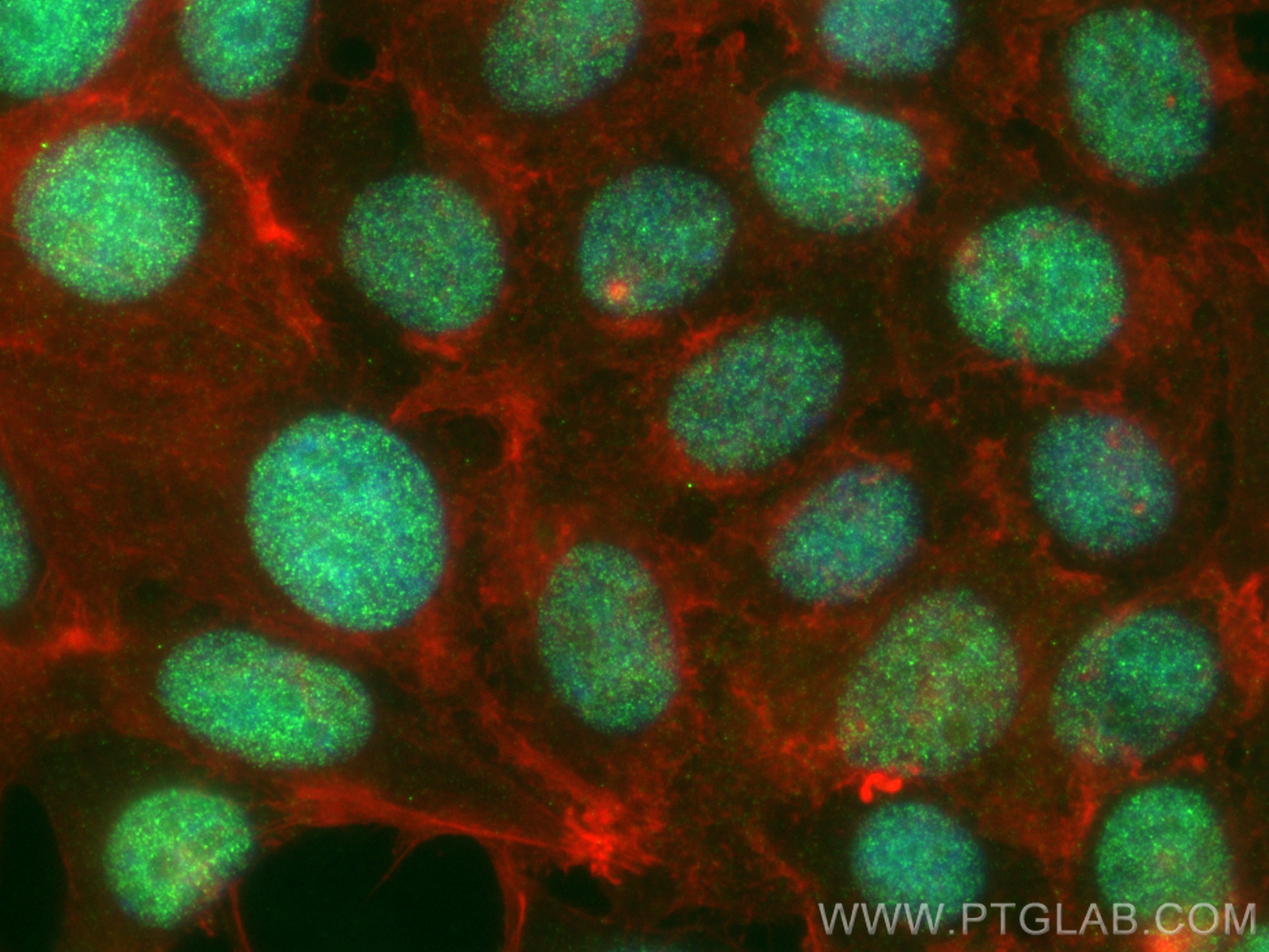 Immunofluorescence (IF) / fluorescent staining of MCF-7 cells using NSD3 Recombinant antibody (83116-1-RR)