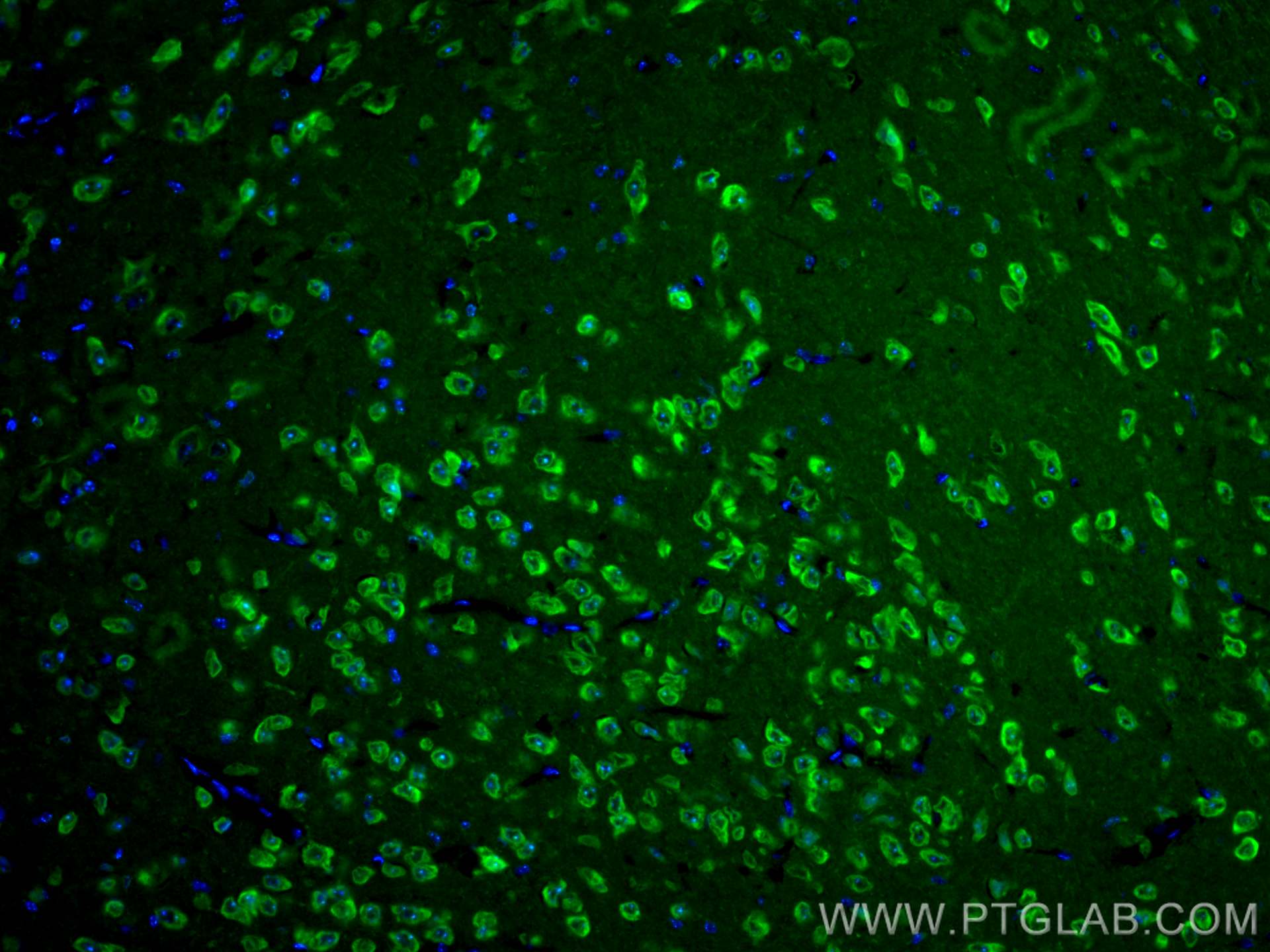 Immunofluorescence (IF) / fluorescent staining of mouse brain tissue using CoraLite® Plus 488-conjugated NSE Monoclonal antib (CL488-66150)