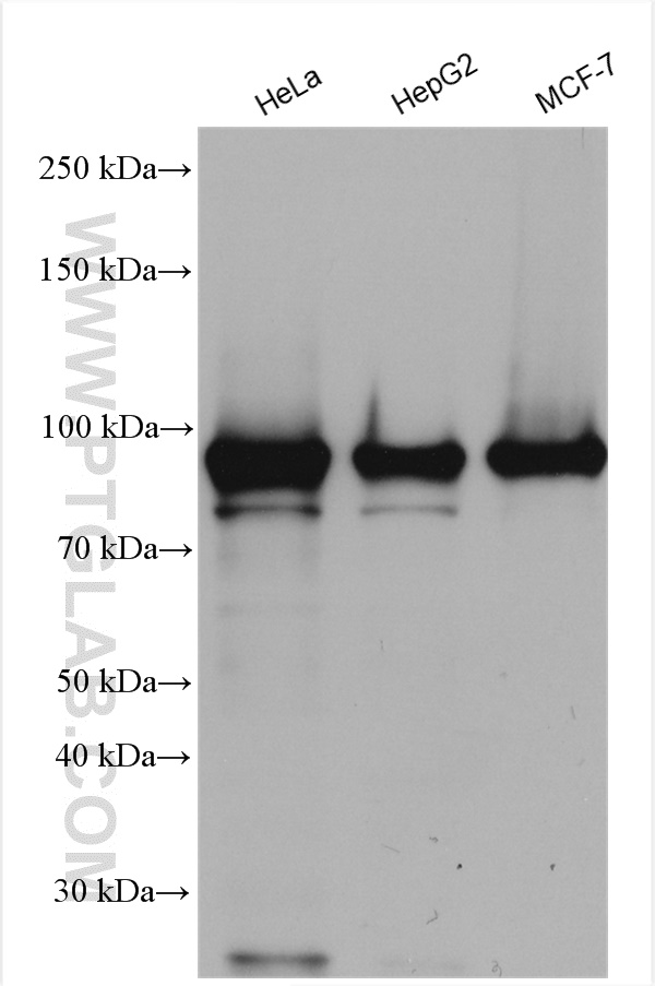KCNN2 (KCa2.2, SK2) Polyclonal Antibody (APC-028-200UL)