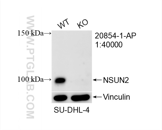 Western Blot (WB) analysis of SU-DHL-4 cells using NSUN2 Polyclonal antibody (20854-1-AP)