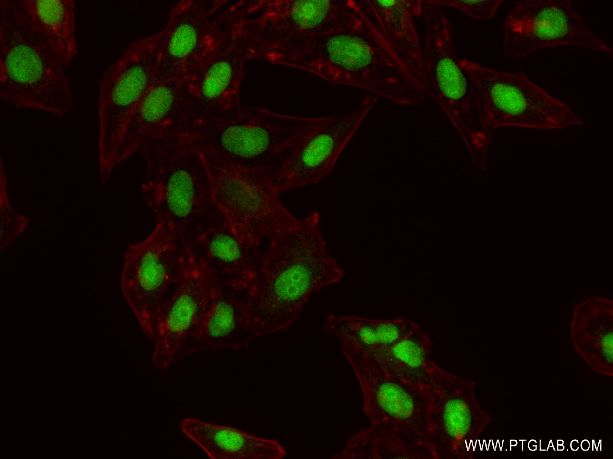 Immunofluorescence (IF) / fluorescent staining of HepG2 cells using NSUN2 Recombinant antibody (82894-1-RR)