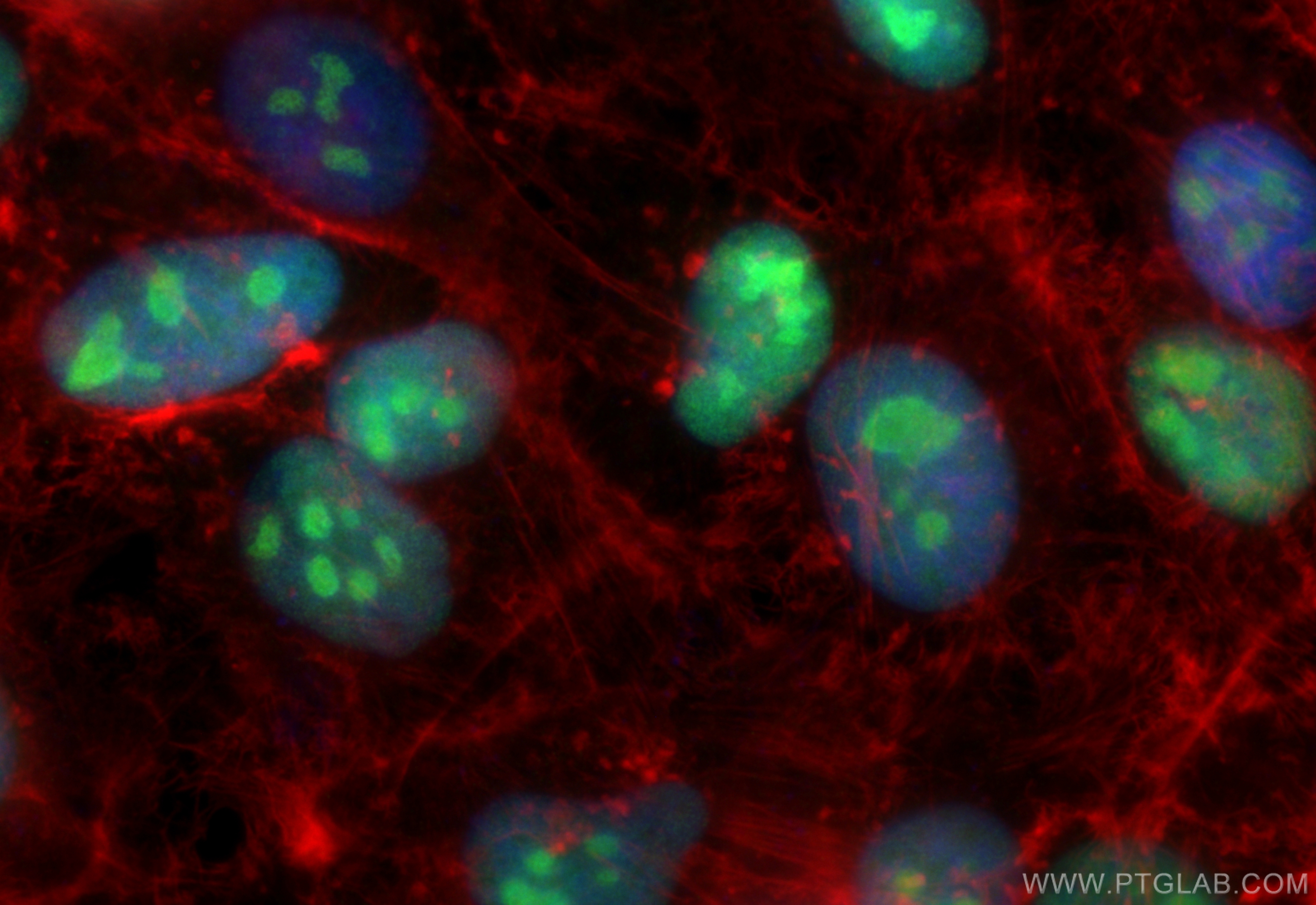 Immunofluorescence (IF) / fluorescent staining of HeLa cells using NSUN2 Recombinant antibody (82894-2-RR)