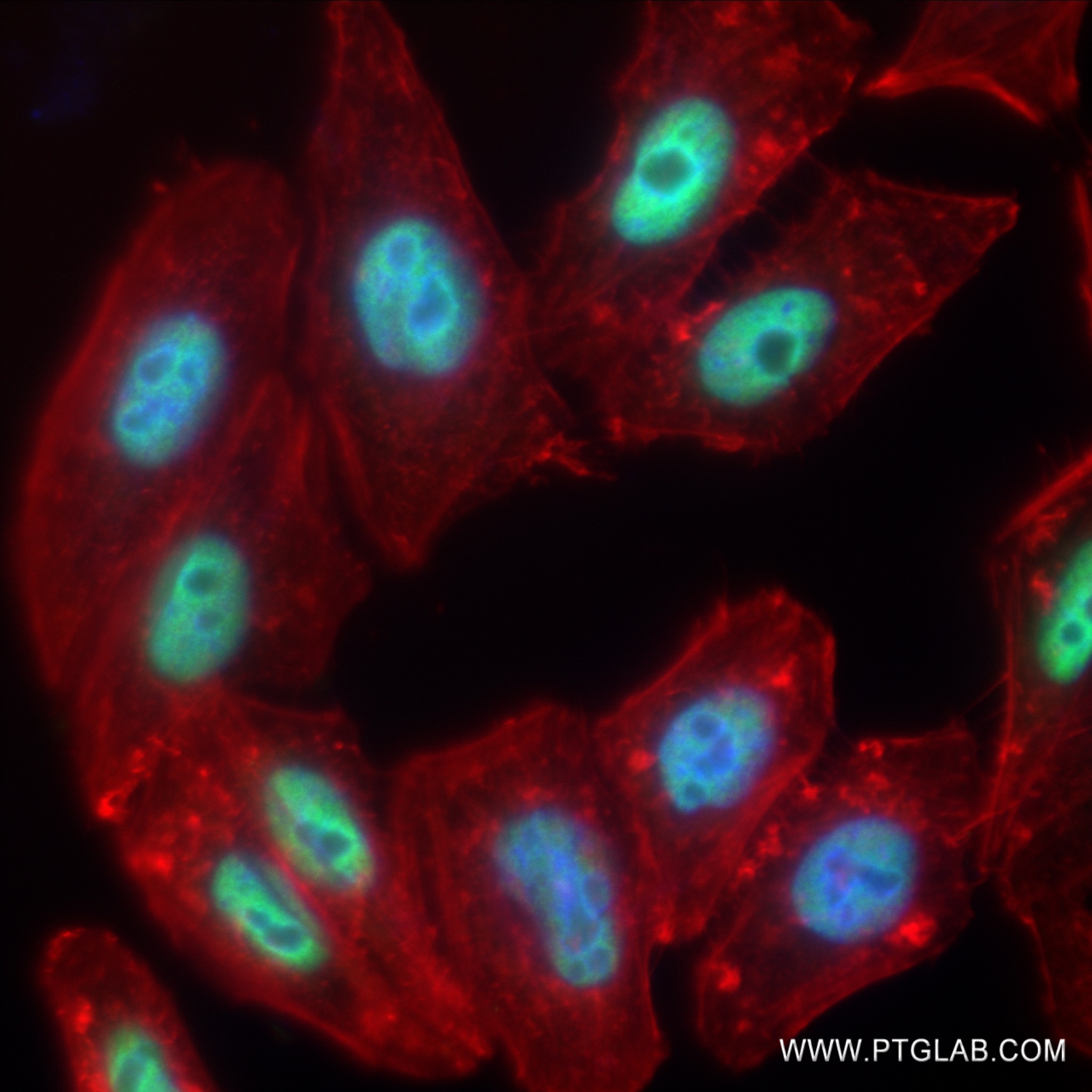 Immunofluorescence (IF) / fluorescent staining of HepG2 cells using NSUN2 Recombinant antibody (82894-7-RR)
