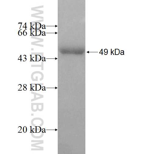 NSUN4 fusion protein Ag9417 SDS-PAGE