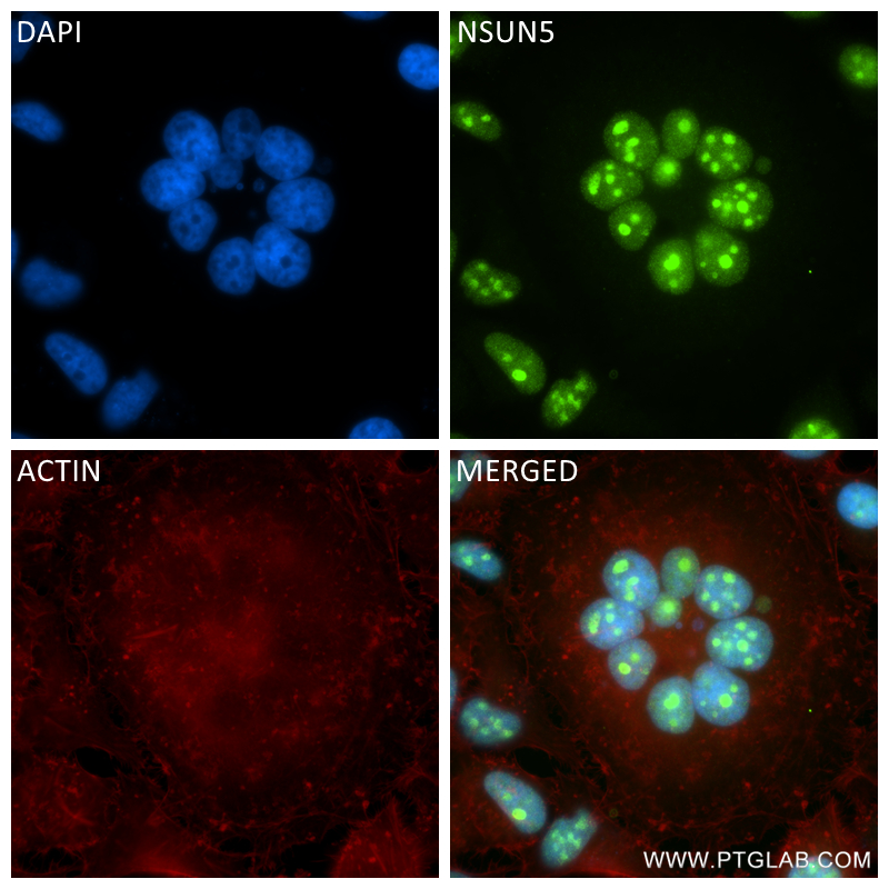 Immunofluorescence (IF) / fluorescent staining of HeLa cells using NSUN5 Recombinant antibody (84768-2-RR)