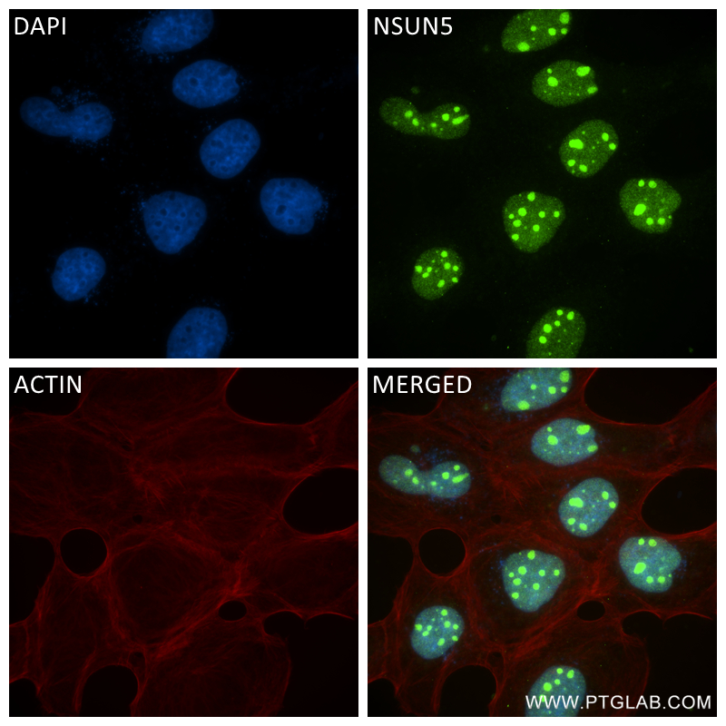 Immunofluorescence (IF) / fluorescent staining of A431 cells using NSUN5 Recombinant antibody (84768-2-RR)