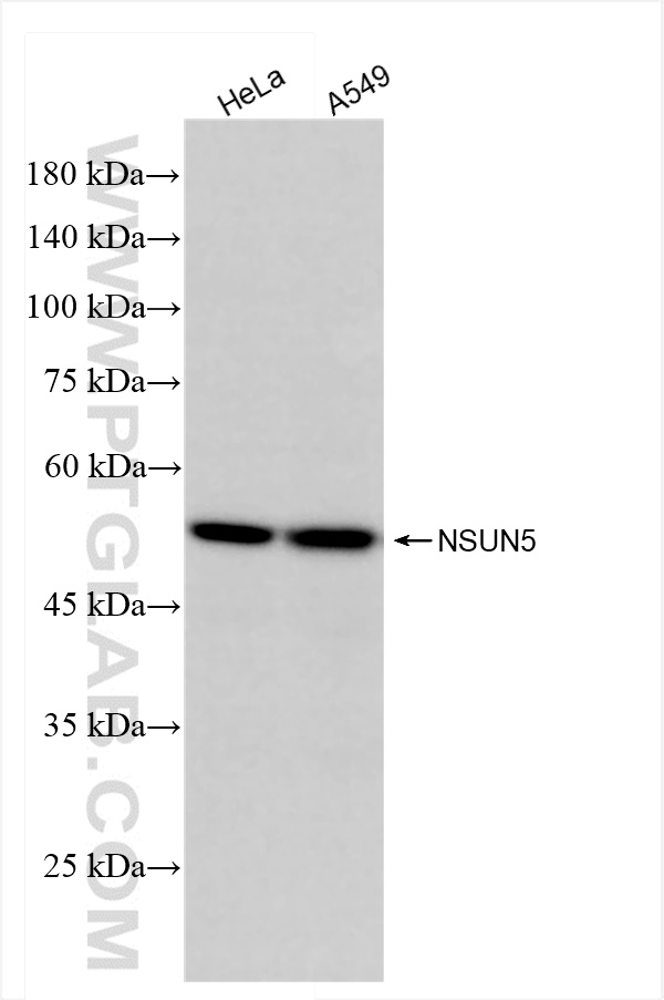 Western Blot (WB) analysis of various lysates using NSUN5 Recombinant antibody (84768-2-RR)