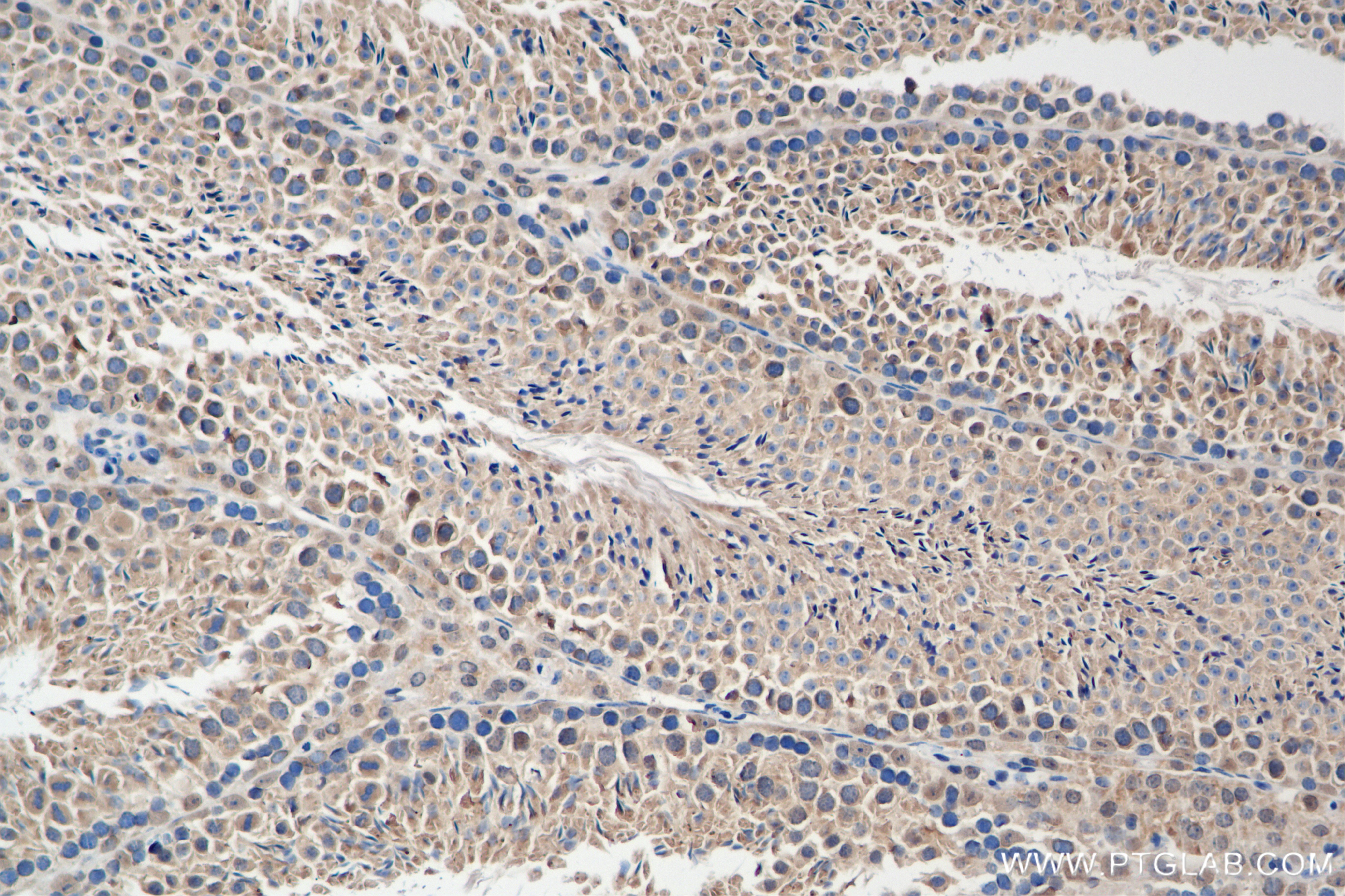 Immunohistochemistry (IHC) staining of mouse testis tissue using NSUN7 Recombinant antibody (84795-1-RR)