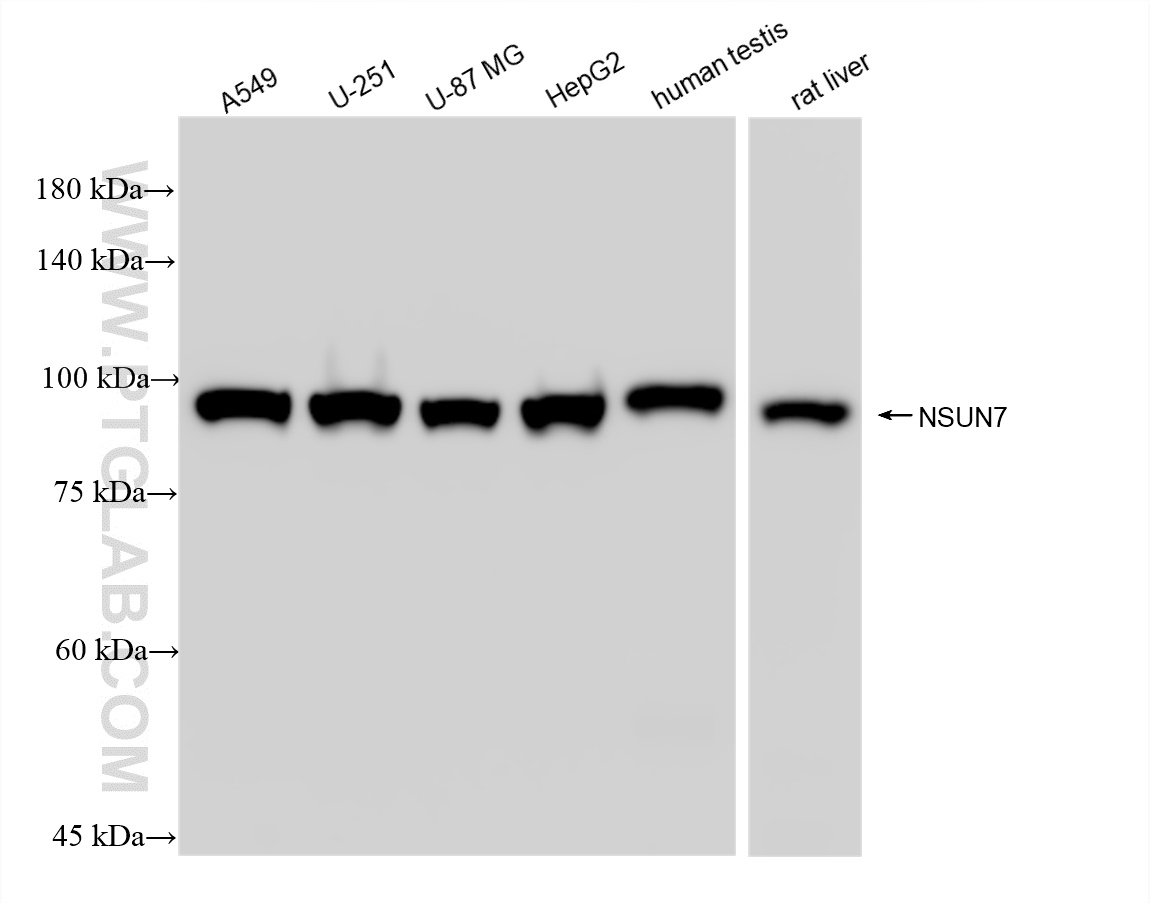 Western Blot (WB) analysis of various lysates using NSUN7 Recombinant antibody (84795-1-RR)