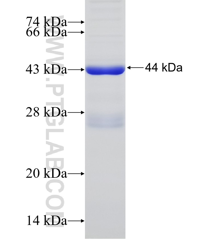 NSUN7 fusion protein Ag31860 SDS-PAGE