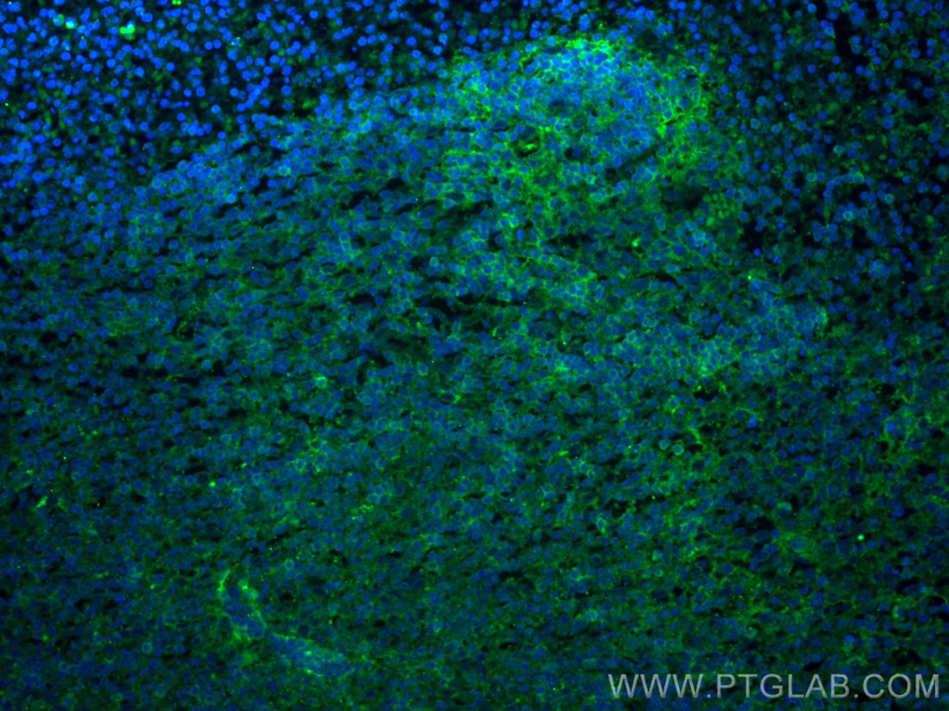 Immunofluorescence (IF) / fluorescent staining of human appendicitis tissue using CD73 Polyclonal antibody (12231-1-AP)