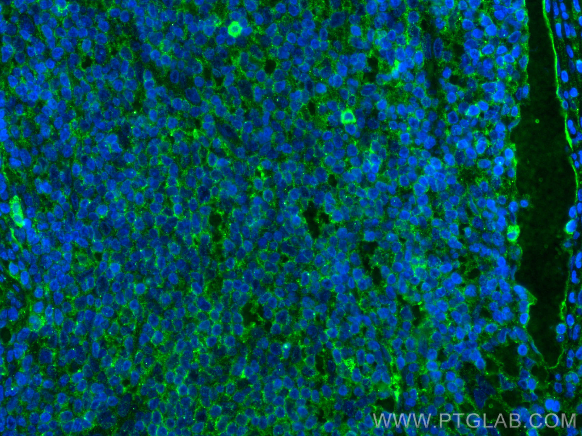 Immunofluorescence (IF) / fluorescent staining of human appendicitis tissue using NT5E/CD73 Monoclonal antibody (67789-1-Ig)