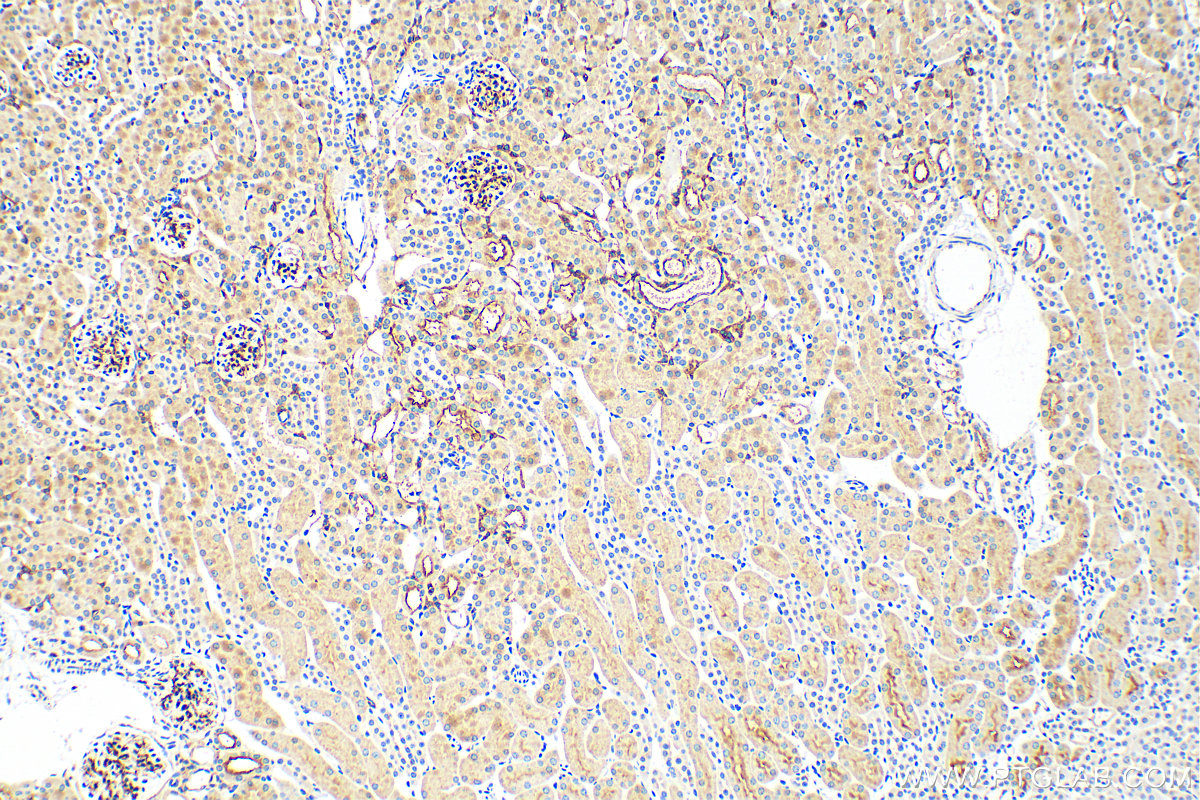 Immunohistochemistry (IHC) staining of mouse kidney tissue using NT5E/CD73 Monoclonal antibody (67789-1-Ig)