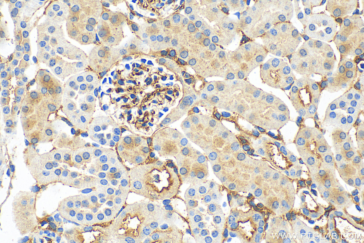 Immunohistochemistry (IHC) staining of mouse kidney tissue using NT5E/CD73 Monoclonal antibody (67789-1-Ig)