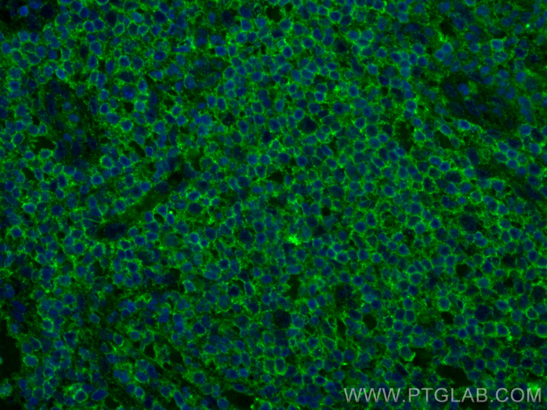 Immunofluorescence (IF) / fluorescent staining of human appendicitis tissue using CoraLite® Plus 488-conjugated NT5E/CD73 Monoclonal (CL488-67789)
