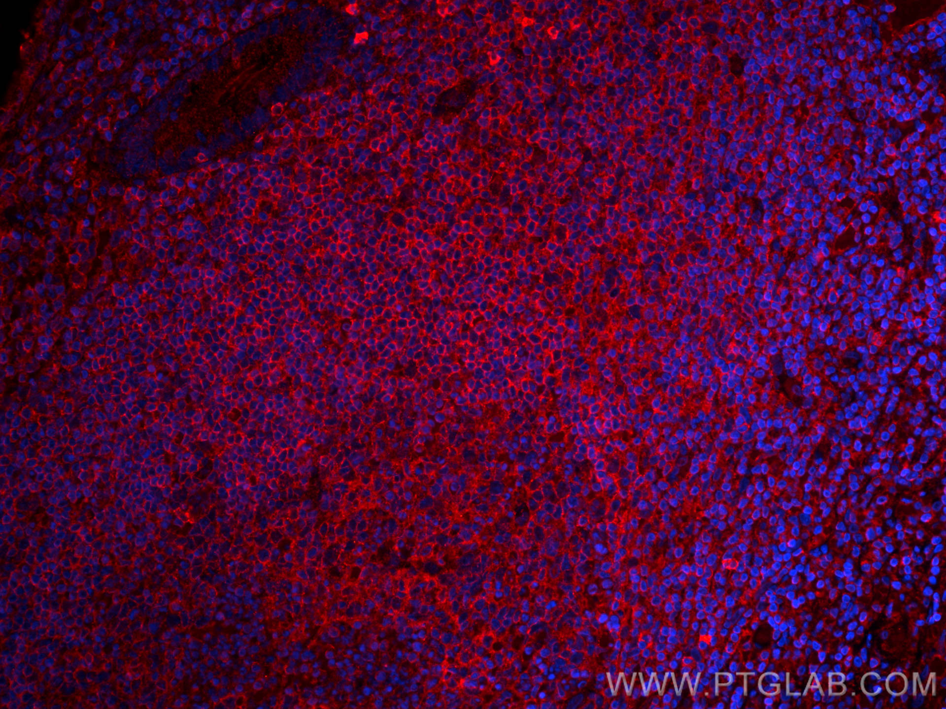 Immunofluorescence (IF) / fluorescent staining of human appendicitis tissue using CoraLite®594-conjugated NT5E/CD73 Monoclonal antib (CL594-67789)
