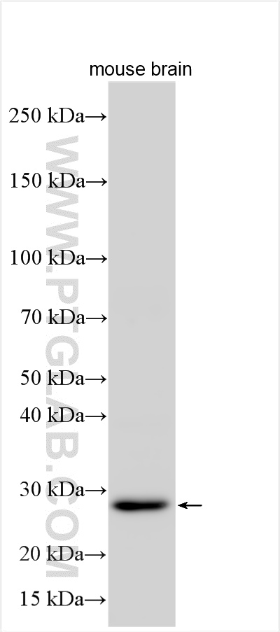 Western Blot (WB) analysis of various lysates using NT5M Polyclonal antibody (20765-1-AP)
