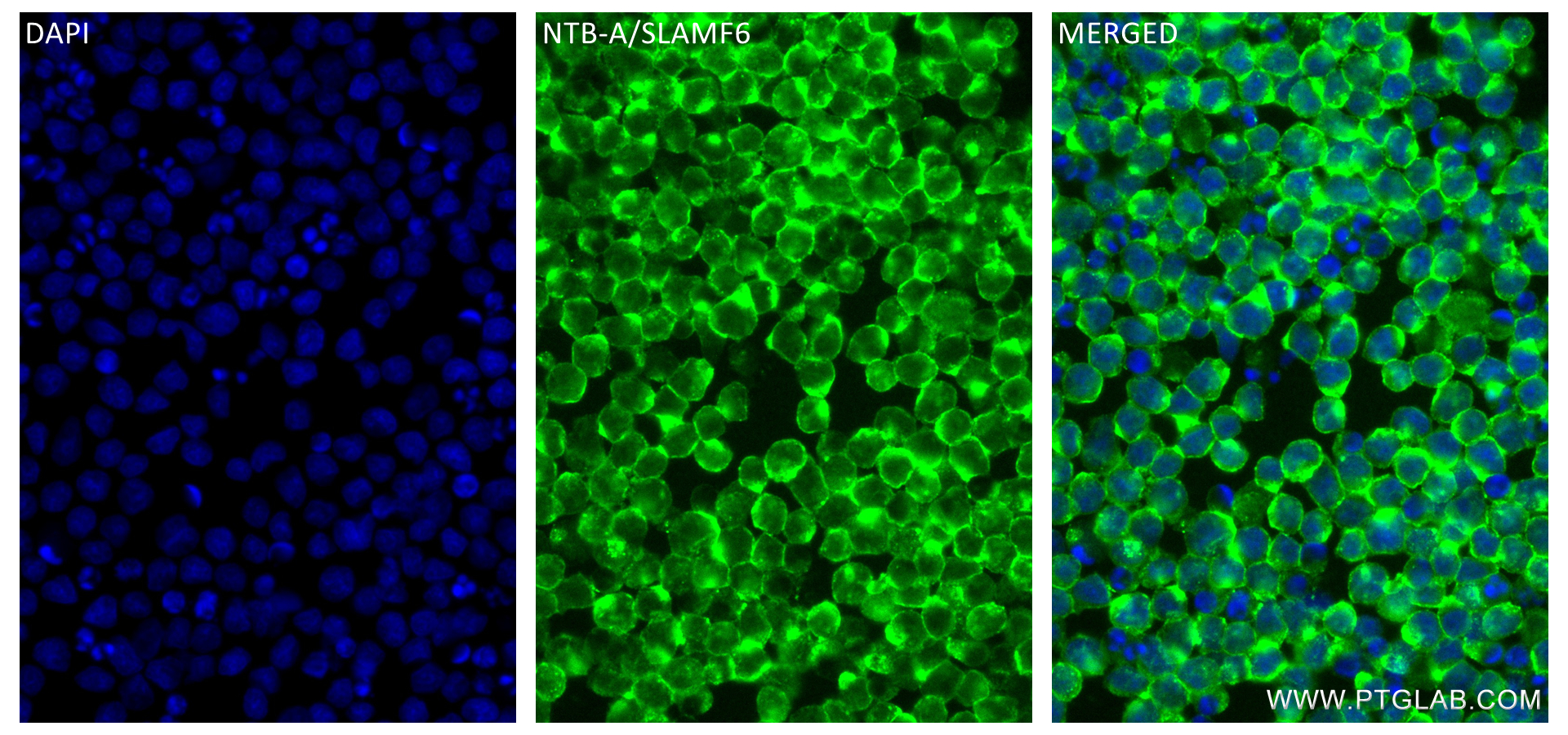 Immunofluorescence (IF) / fluorescent staining of Ramos cells using NTB-A/SLAMF6 Recombinant antibody (84211-4-RR)