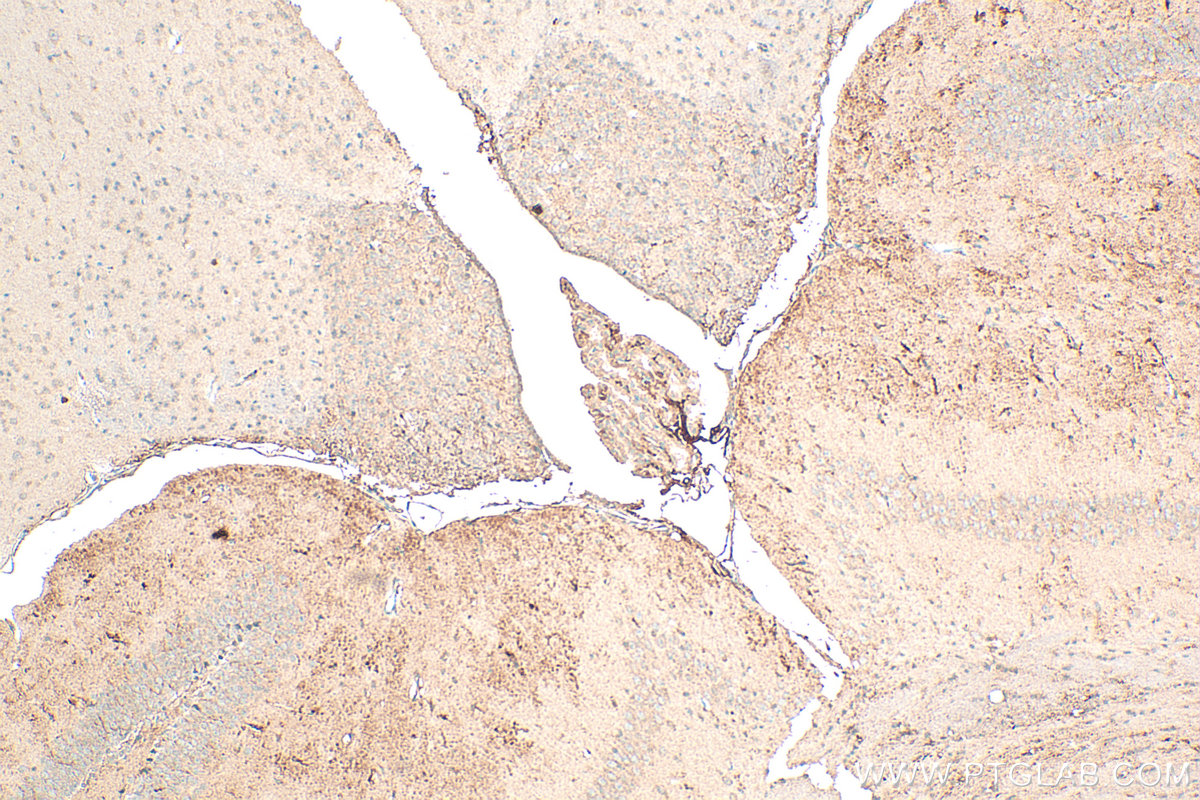 Immunohistochemistry (IHC) staining of mouse brain tissue using Neurotrophin 3 Polyclonal antibody (18084-1-AP)