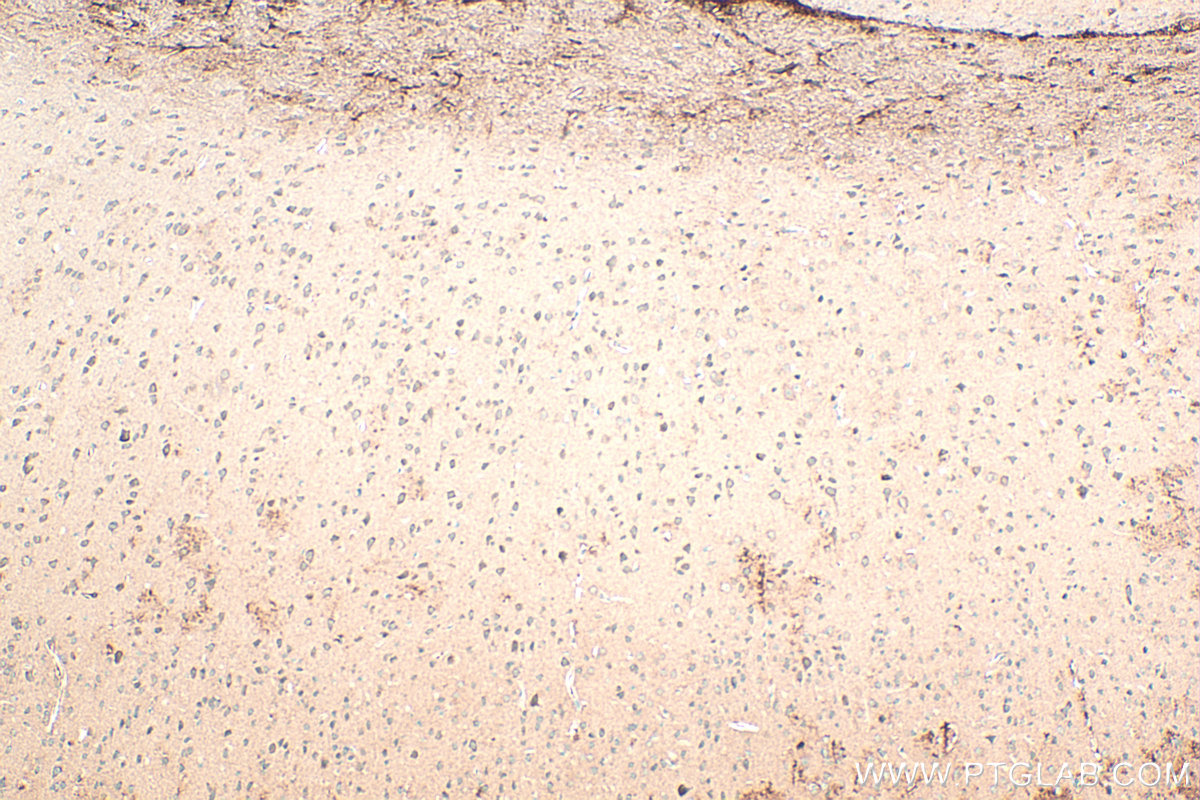 Immunohistochemistry (IHC) staining of mouse brain tissue using Neurotrophin 3 Polyclonal antibody (18084-1-AP)