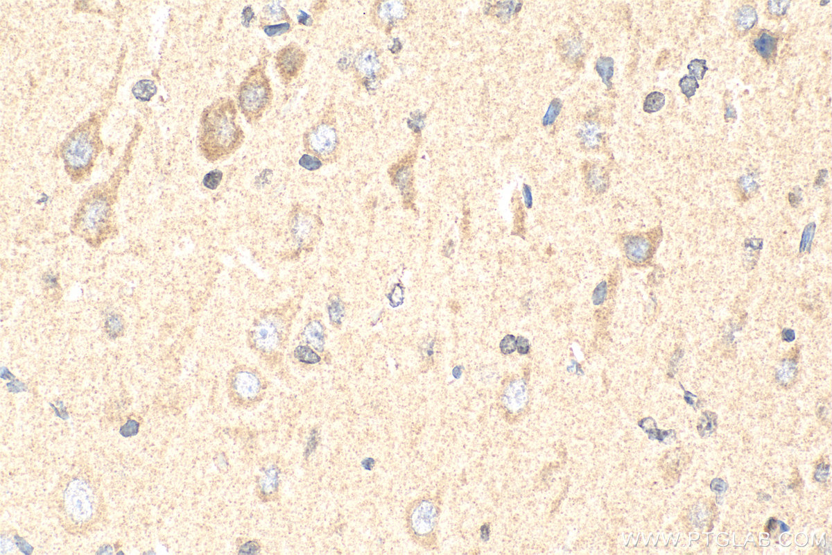 Immunohistochemistry (IHC) staining of rat brain tissue using Neurotrophin 3 Polyclonal antibody (18084-1-AP)