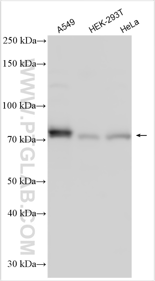 Western Blot (WB) analysis of various lysates using NUAK2 Polyclonal antibody (31718-1-AP)