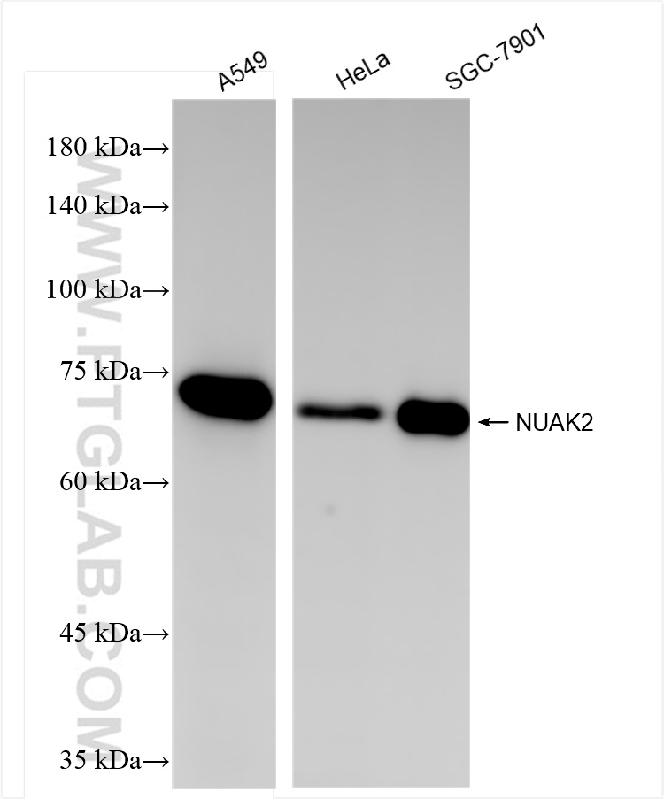 Western Blot (WB) analysis of various lysates using NUAK2 Recombinant antibody (84849-4-RR)