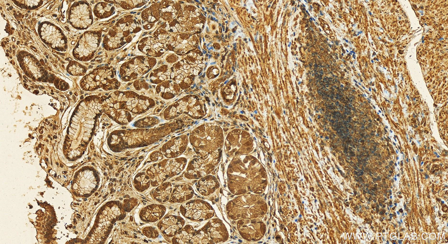 Immunohistochemistry (IHC) staining of human stomach tissue using NUBP1 Polyclonal antibody (18011-1-AP)