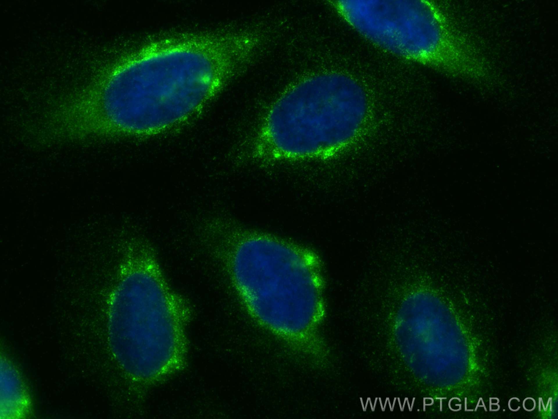 Immunofluorescence (IF) / fluorescent staining of U2OS cells using NUCB2/nesfatin-1 Polyclonal antibody (30604-1-AP)