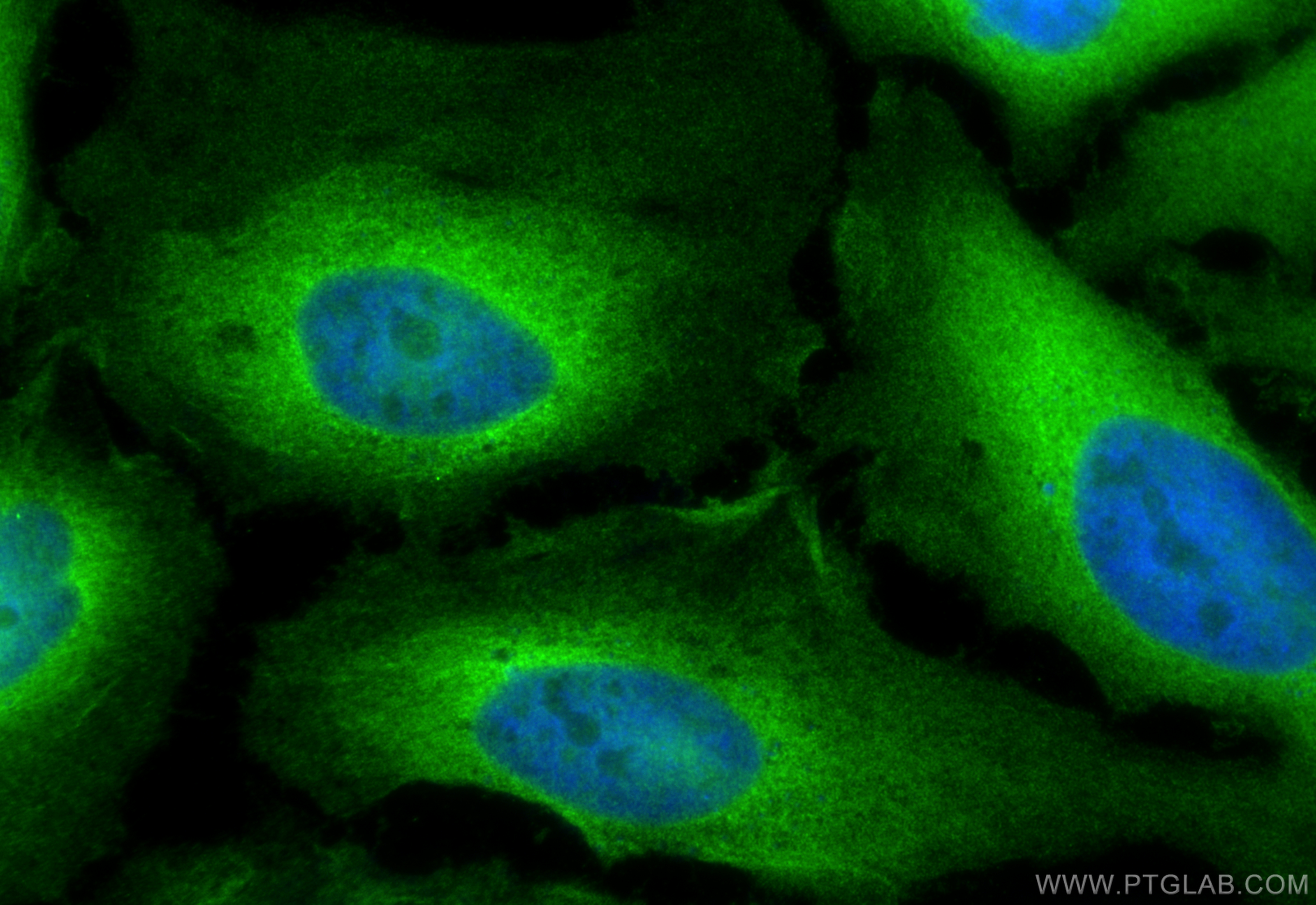 Immunofluorescence (IF) / fluorescent staining of HeLa cells using NUDC Polyclonal antibody (10681-1-AP)