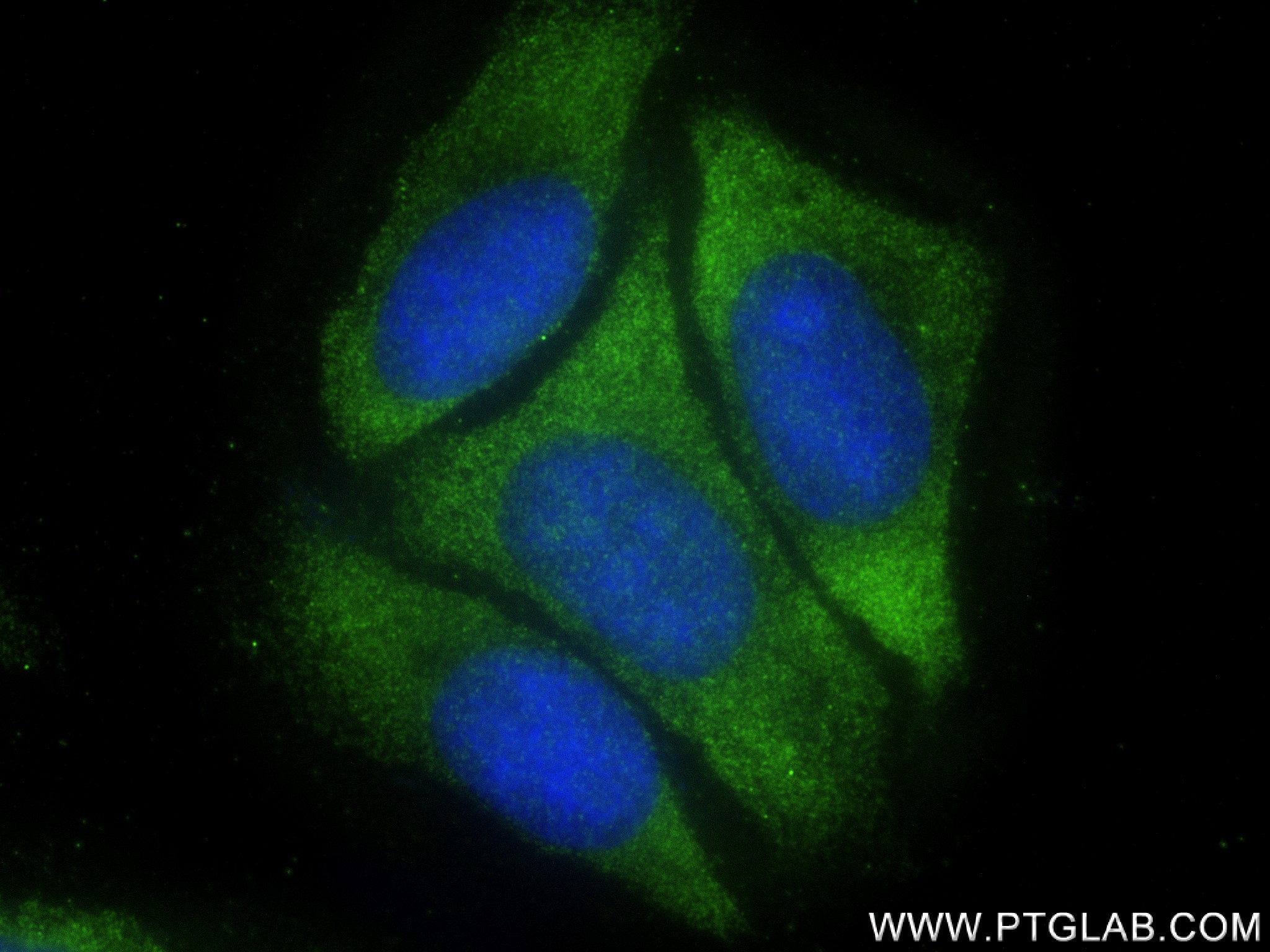 Immunofluorescence (IF) / fluorescent staining of HepG2 cells using NUDCD2 Recombinant antibody (83217-5-RR)